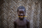 REPUBLIQUE CENTRAFRICAINE, GERE PAR MSF. thumbnail