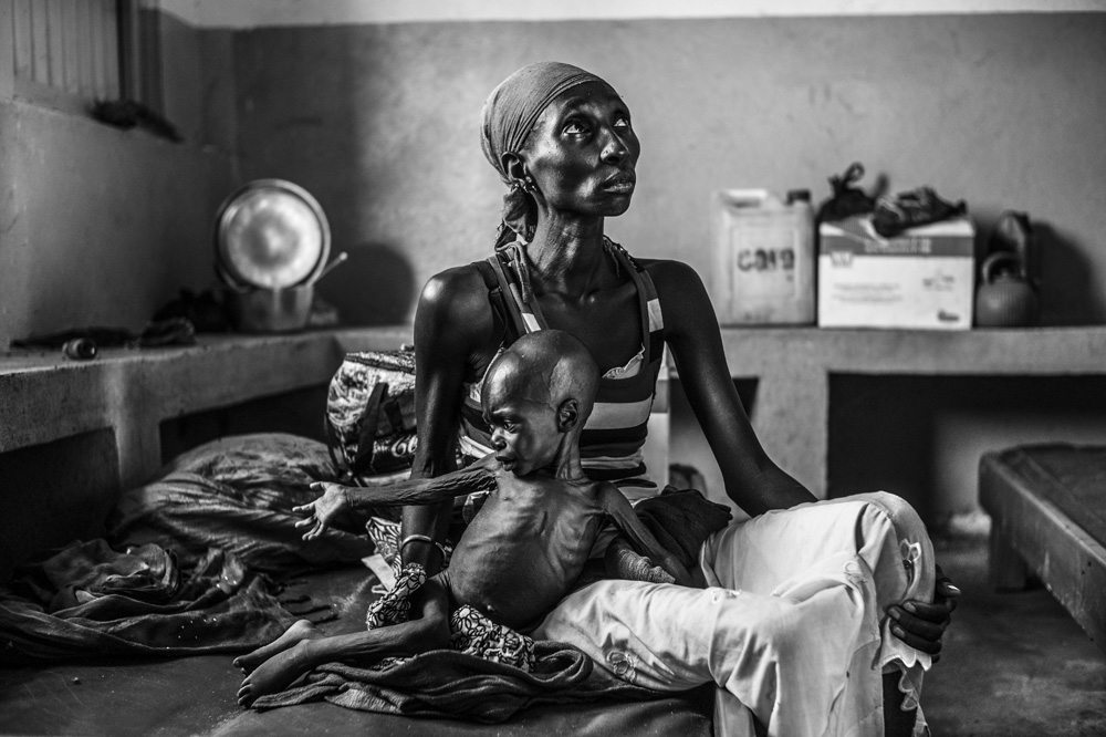 REPORTAGE SUR LA SITUATION ALIMENTAIRE DANS L'HOPITAL DE LA VILLE DE GORE, AU SUD DU TCHAD.